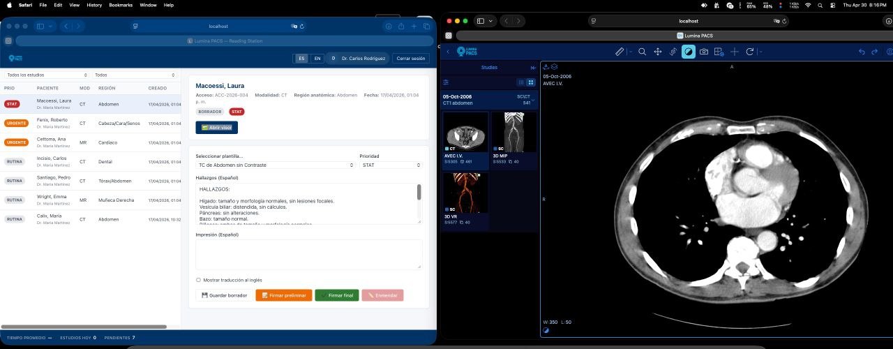 Lumina PACS demo preview